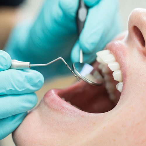 worriedDentistVisit-1169329672-770x533-1